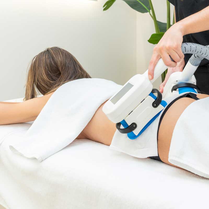 CoolSculpting